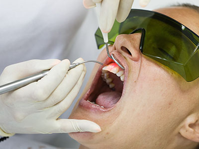 Buena Park Dental | Root Canals, Implant Dentistry and Ceramic Crowns